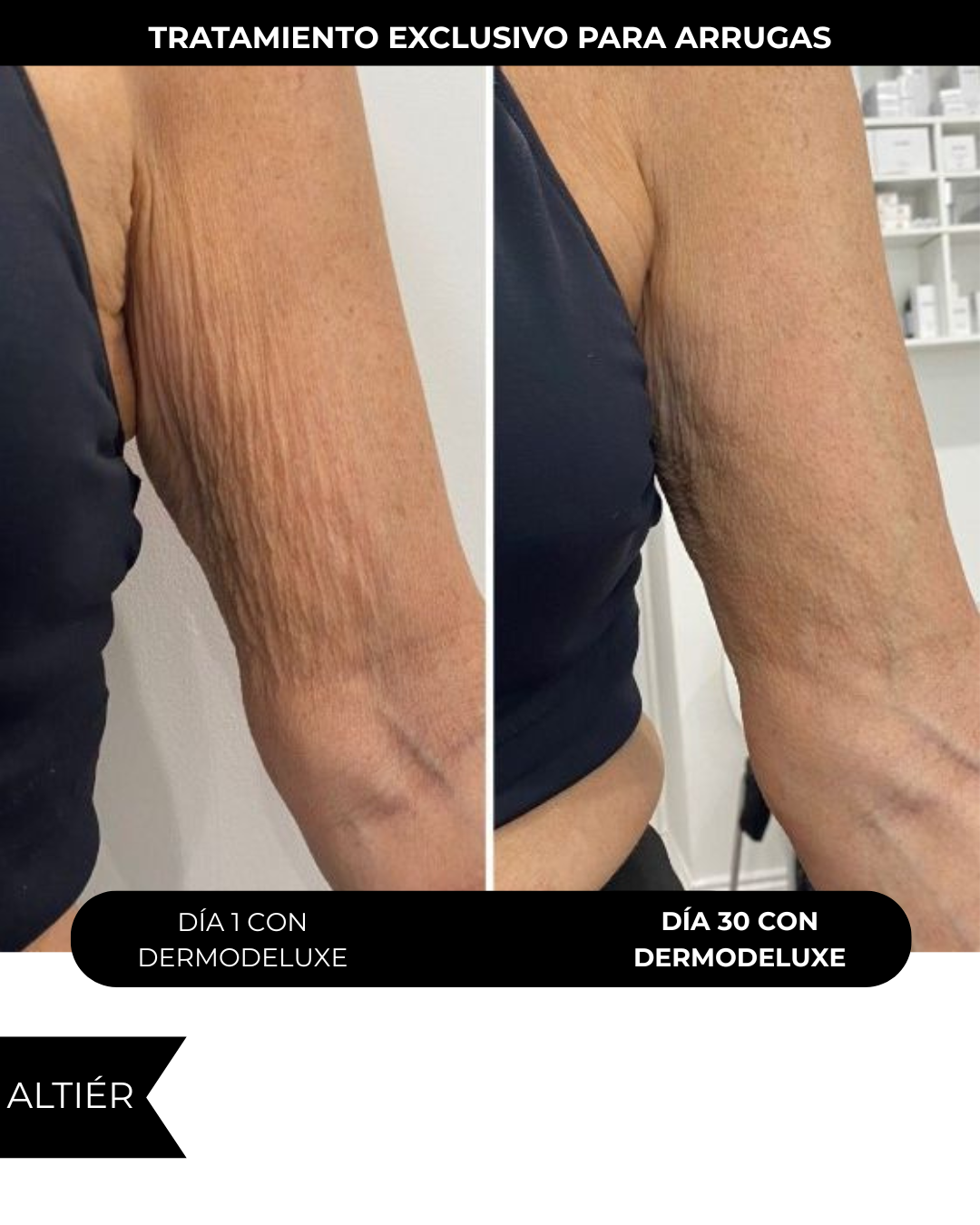 DERMODELUXE – Emulsión Corporal Anticelulitis, Antiflacidez, Antiarrugas y Humectante