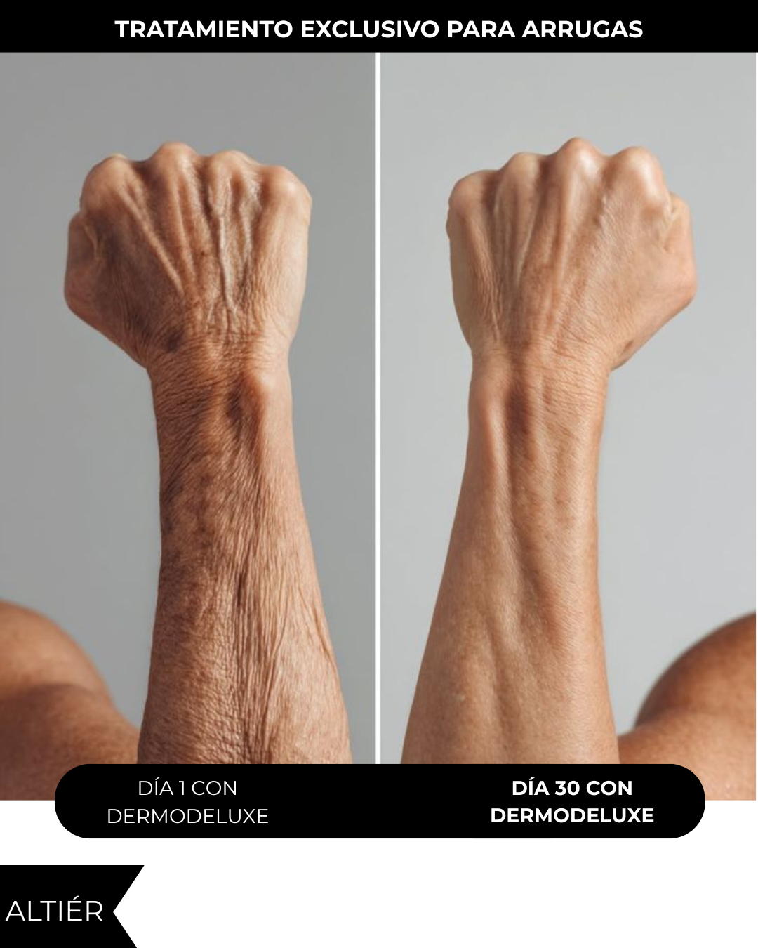 DERMODELUXE – Emulsión Corporal Anticelulitis, Antiflacidez, Antiarrugas y Humectante