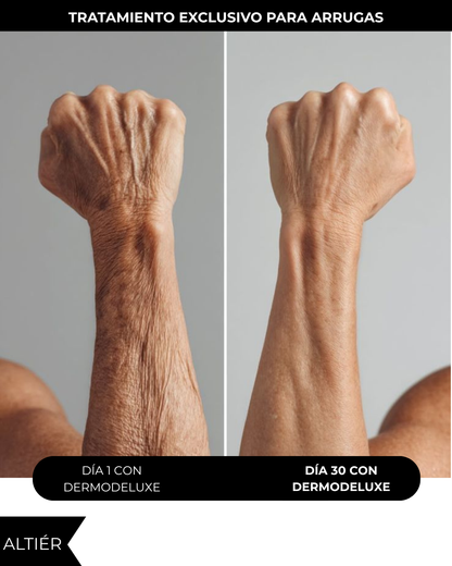 DERMODELUXE – Emulsión Corporal Anticelulitis, Antiflacidez, Antiarrugas y Humectante