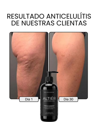 DERMODELUXE – Emulsión Corporal Anticelulitis, Antiflacidez, Antiarrugas y Humectante