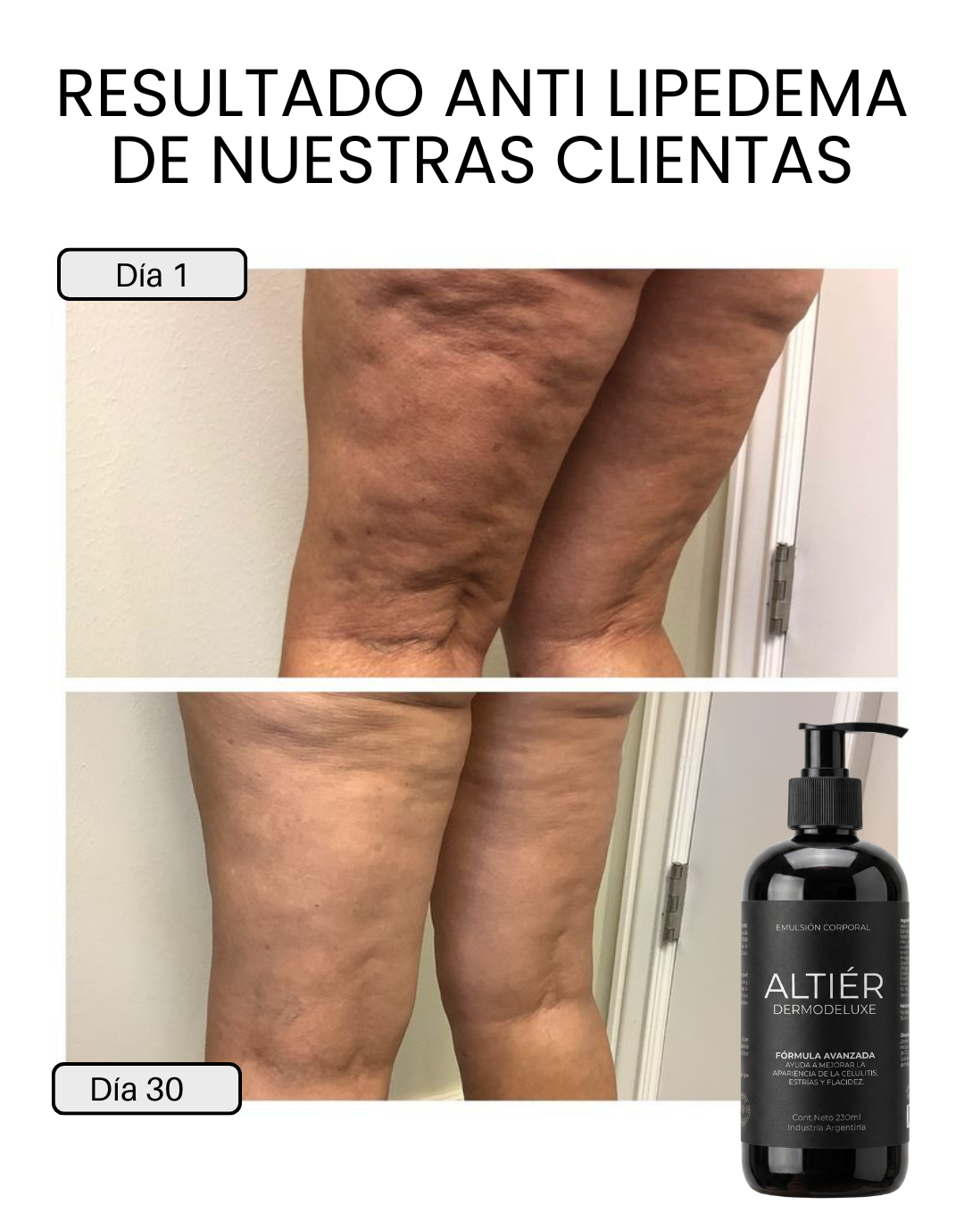 DERMODELUXE – Emulsión Corporal Anticelulitis, Antiflacidez, Antiarrugas y Humectante