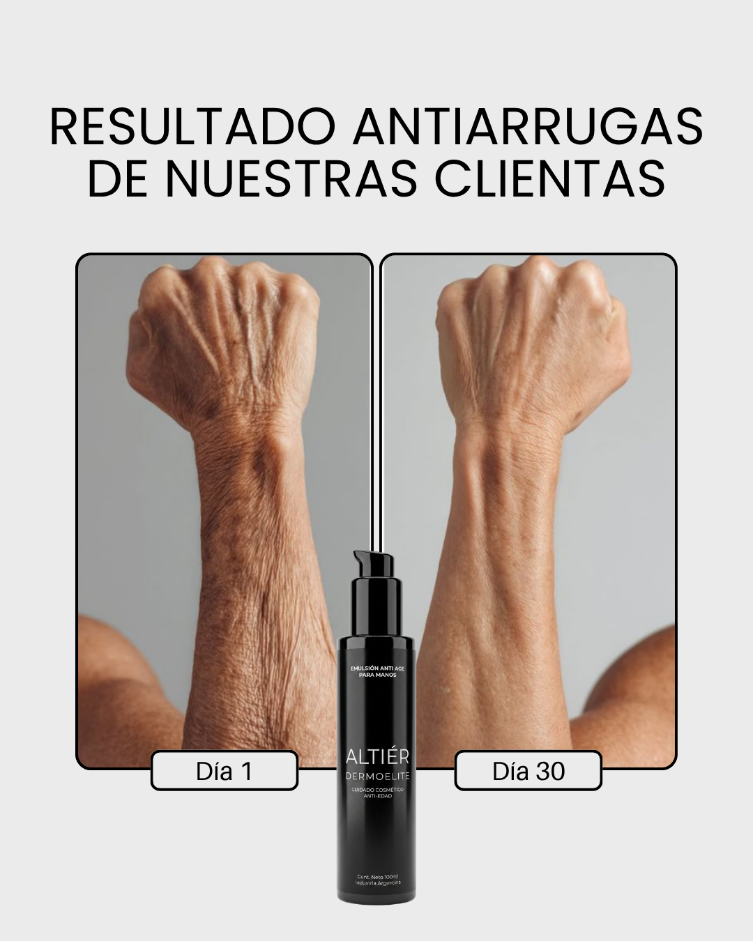 CREMA ANTI-AGE MANOS Y BRAZOS