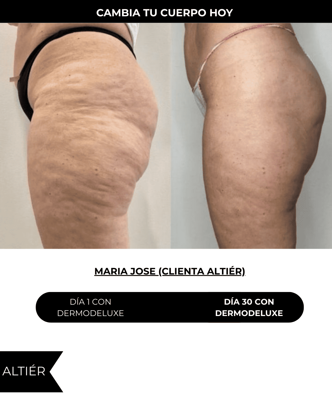 Dermodeluxe Alta Cosmética: Tratamiento para Celulitis, Flacidez, Arrugas y Reafirmante - 230 ML.