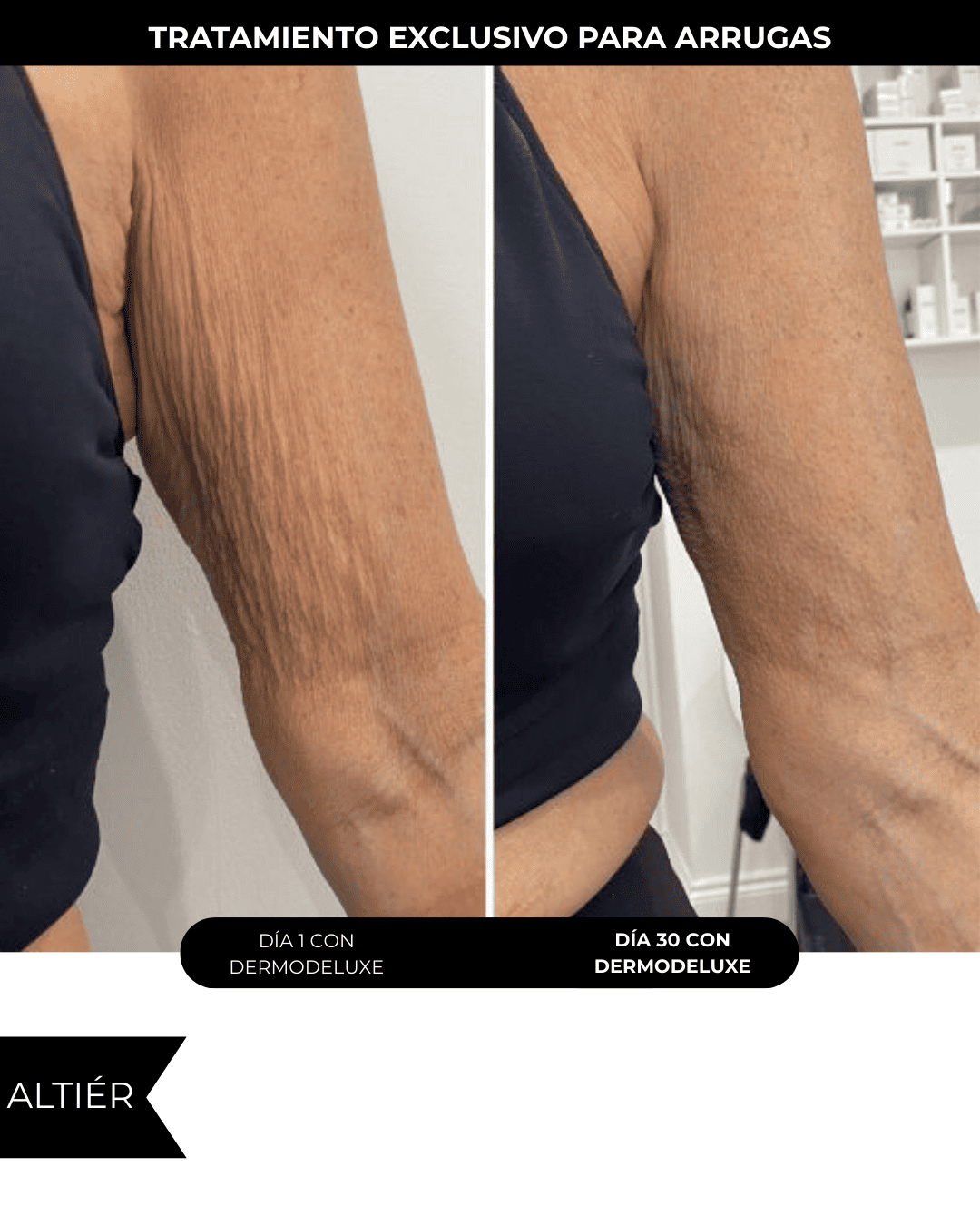 Dermodeluxe Alta Cosmética: Tratamiento para Celulitis, Flacidez, Arrugas y Reafirmante - 230 ML.