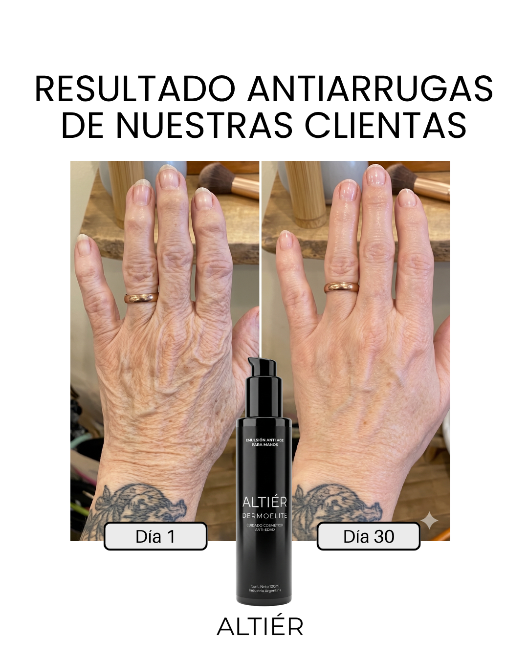 CREMA ANTI-AGE MANOS Y BRAZOS