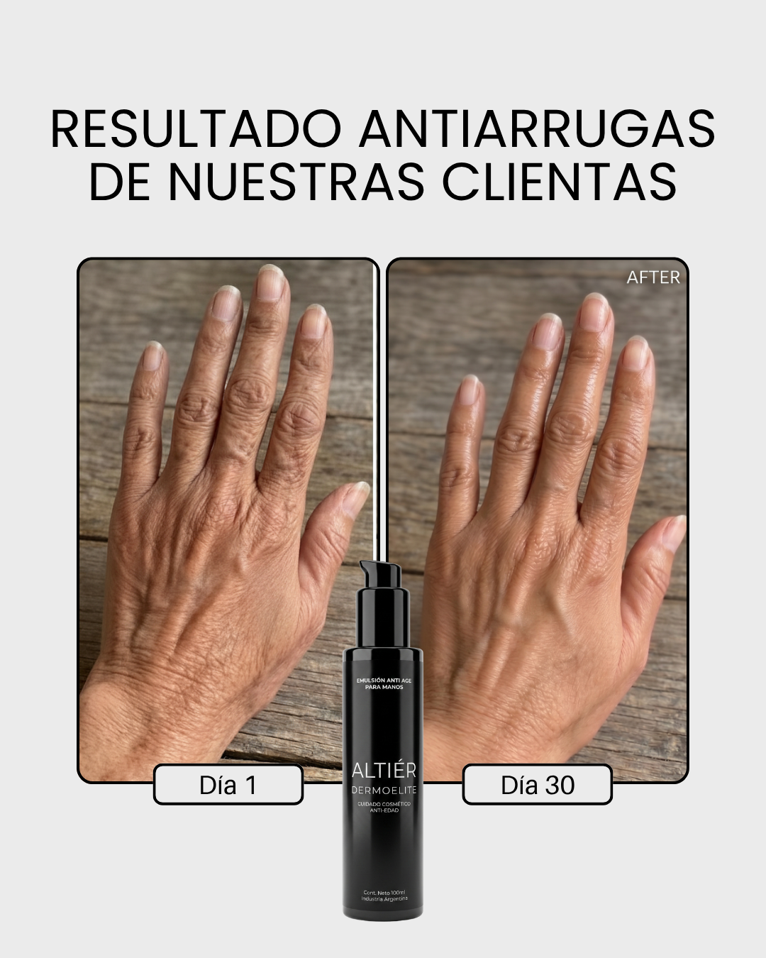 CREMA ANTI-AGE MANOS Y BRAZOS