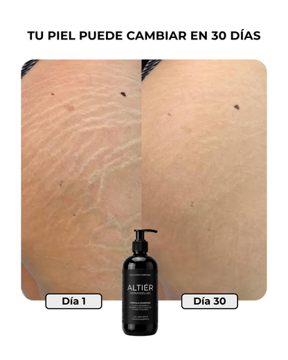 DERMODELUXE - Tratamiento Anti Estrías