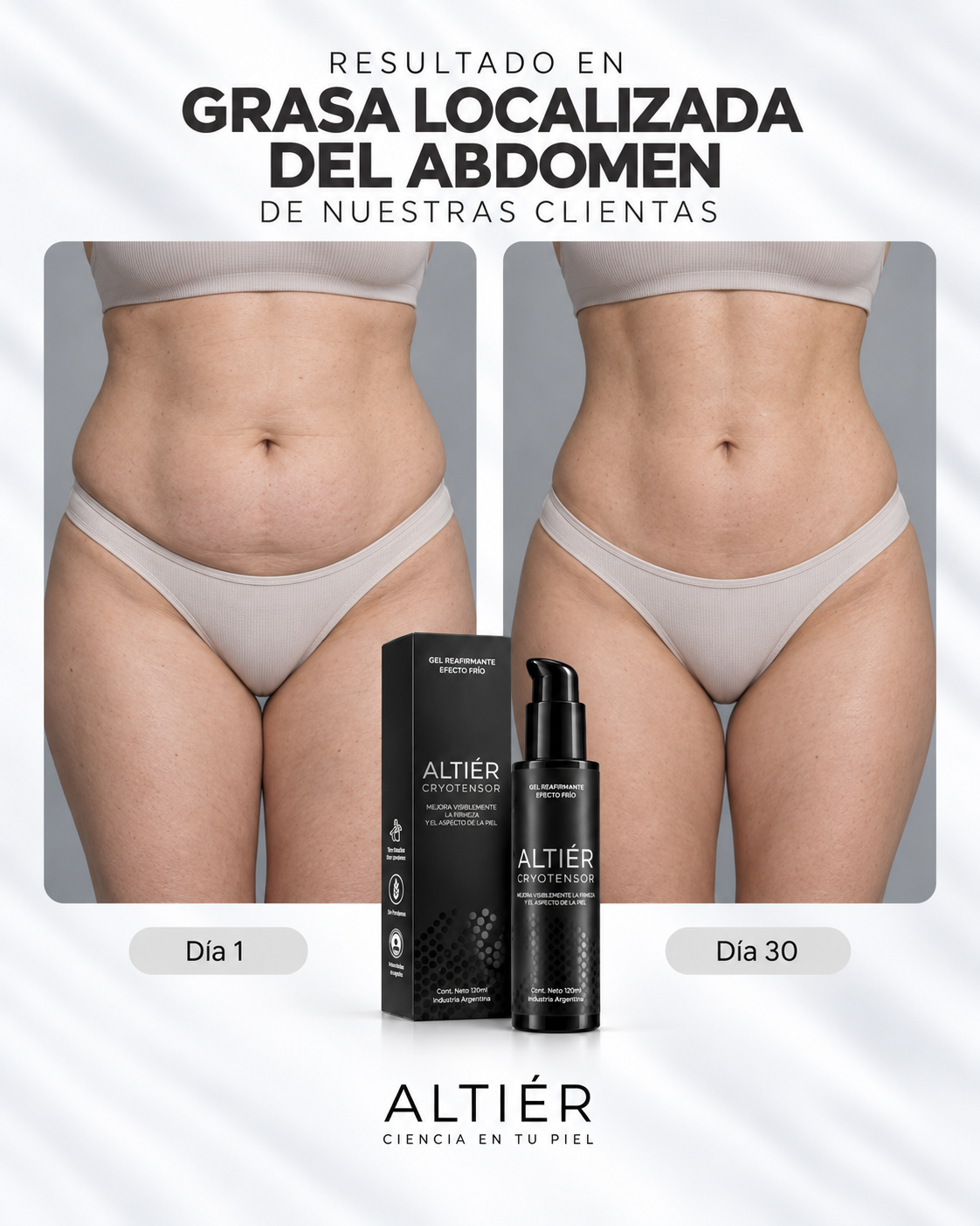 CRYOTENSOR – Gel corporal Reductor · Frío Intenso + Alivio inmediato.