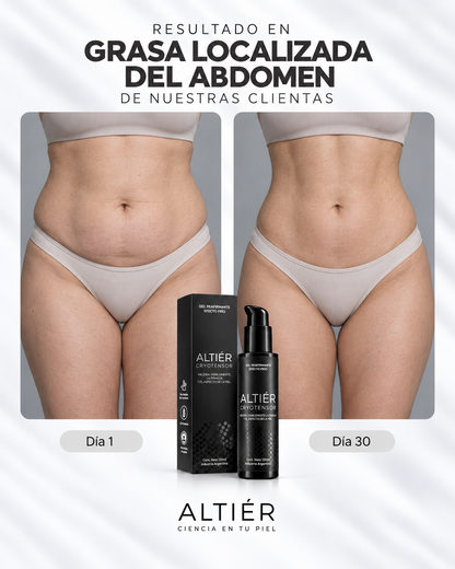 CRYOTENSOR – Gel corporal Reductor · Frío Intenso + Alivio inmediato.