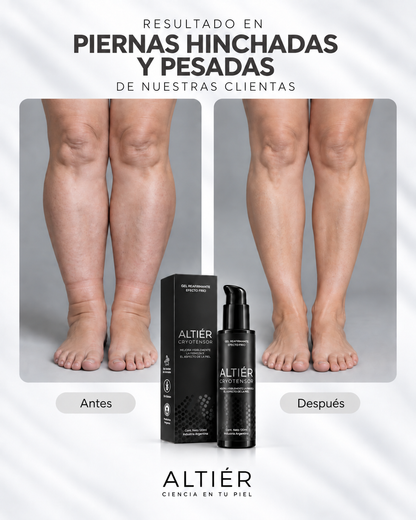 CRYOTENSOR – Gel corporal Reductor · Frío Intenso + Alivio inmediato.